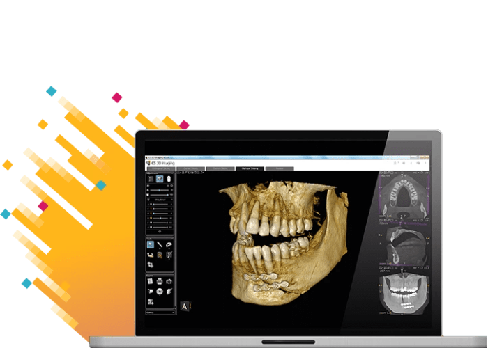 Escaner Oral